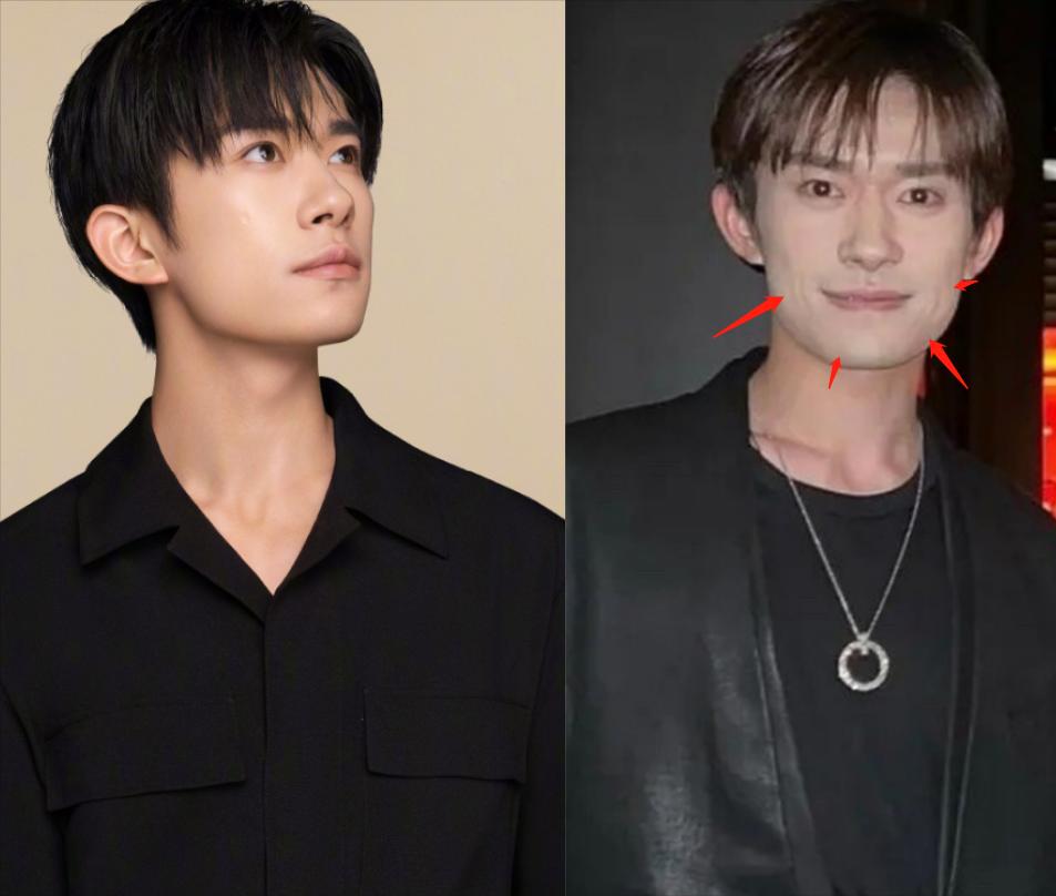 脸上有痘坑的明星,脸上爆痘特别多还好看的明星