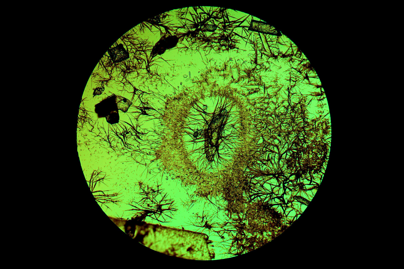 显微镜下结晶图片,显微镜下针状结晶图