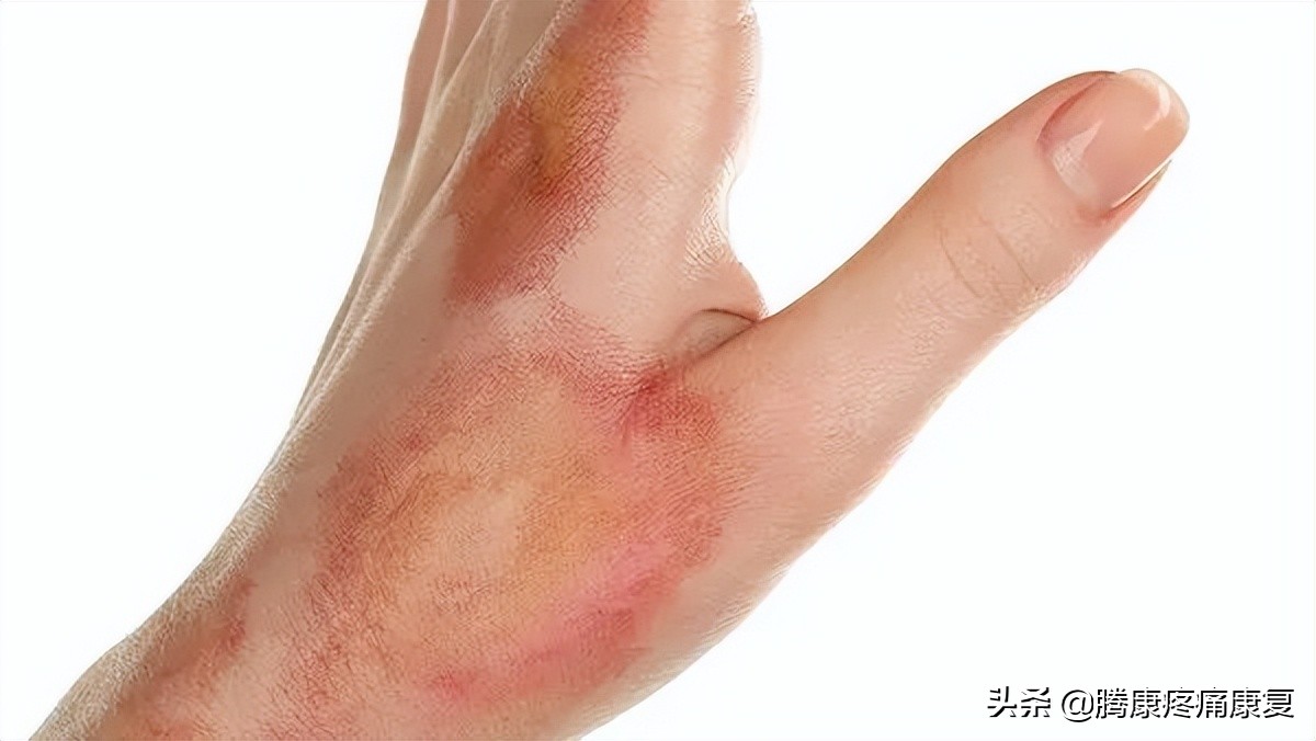 ha玻尿酸极润保湿,ha玻尿酸护肤品好吗