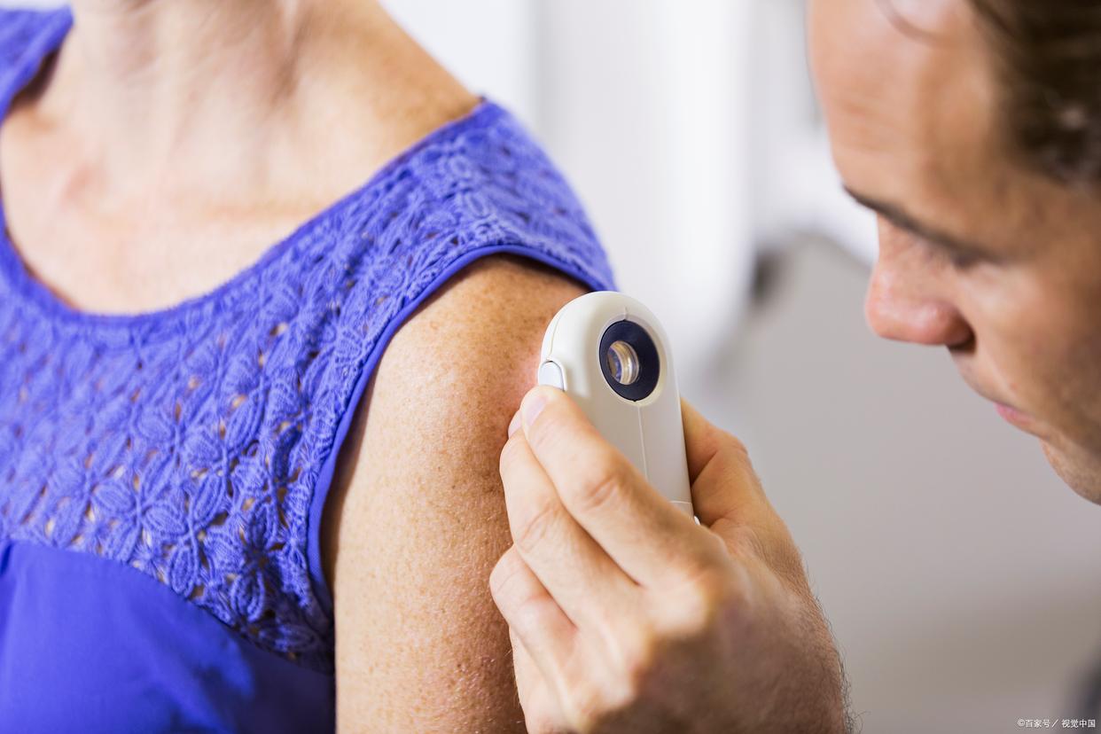 错把艾滋病当皮肤病,皮肤出现三种情况是艾滋病信号