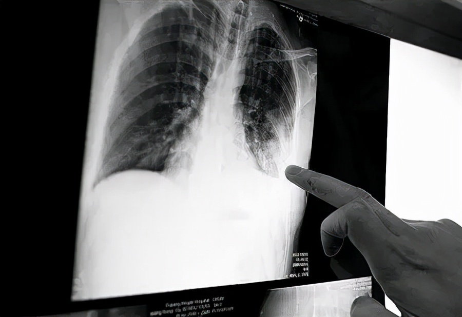 老烟民吸烟不过肺,为什么有的老烟民不得慢阻肺