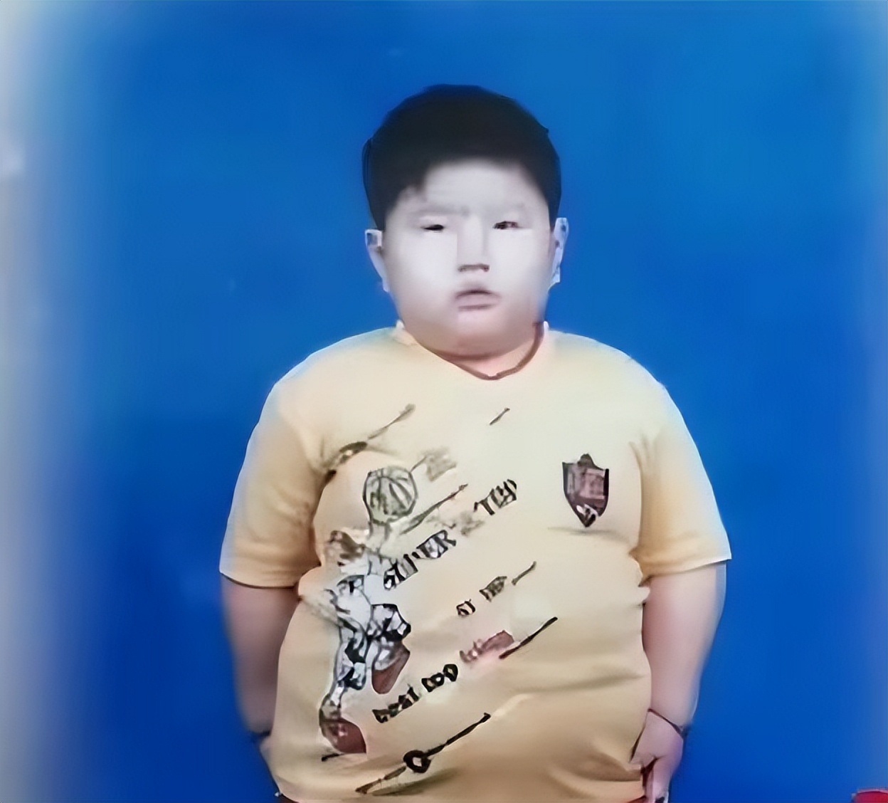 江西一男孩14岁达到300斤,10岁男孩一顿吃三碗体重飙到130斤