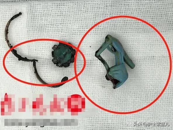 6岁女孩出血怎么回事不疼,6岁女孩出血怎么回事