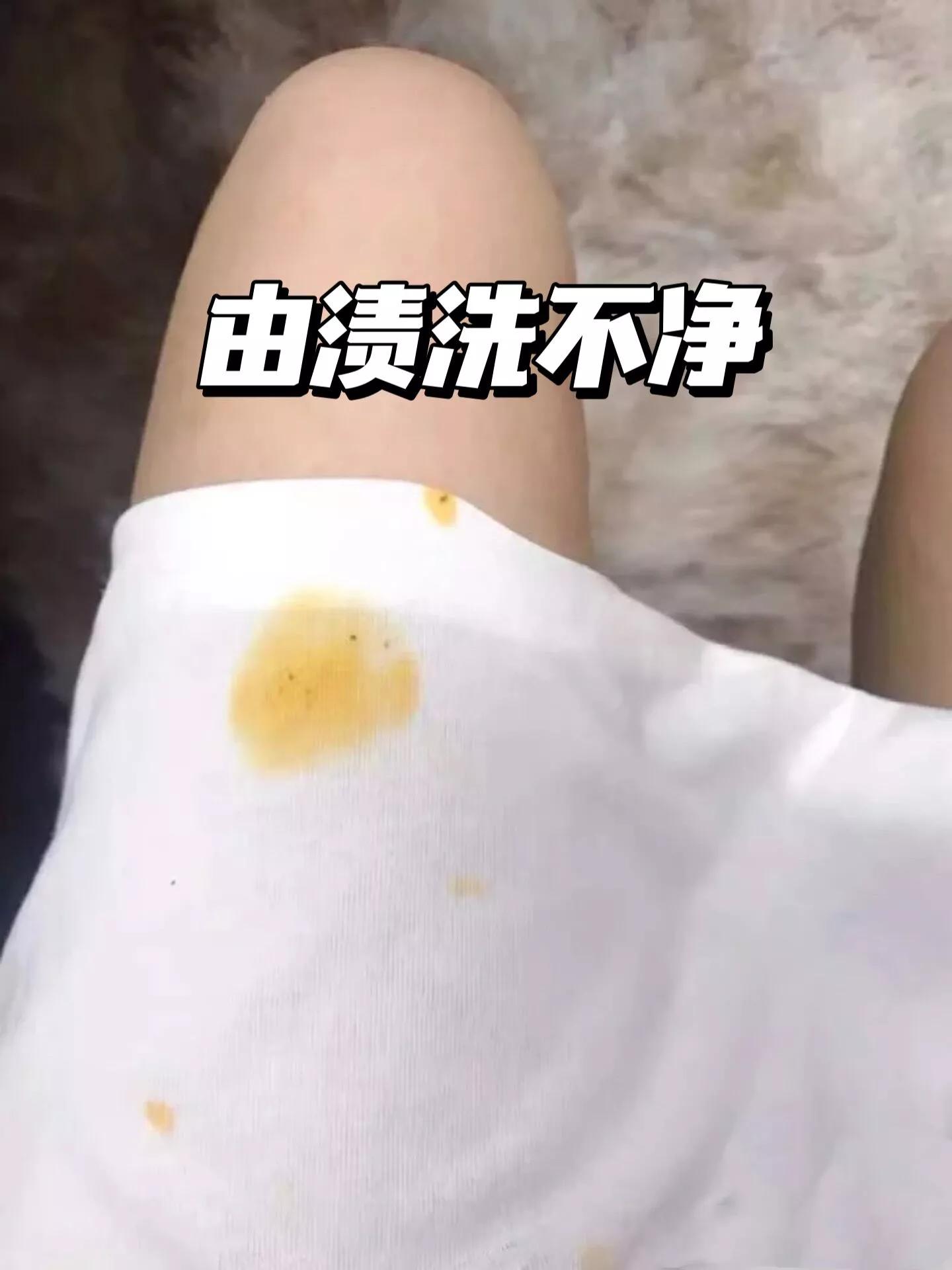 15岁怎么避免长残,男生17岁如何减缓衰老