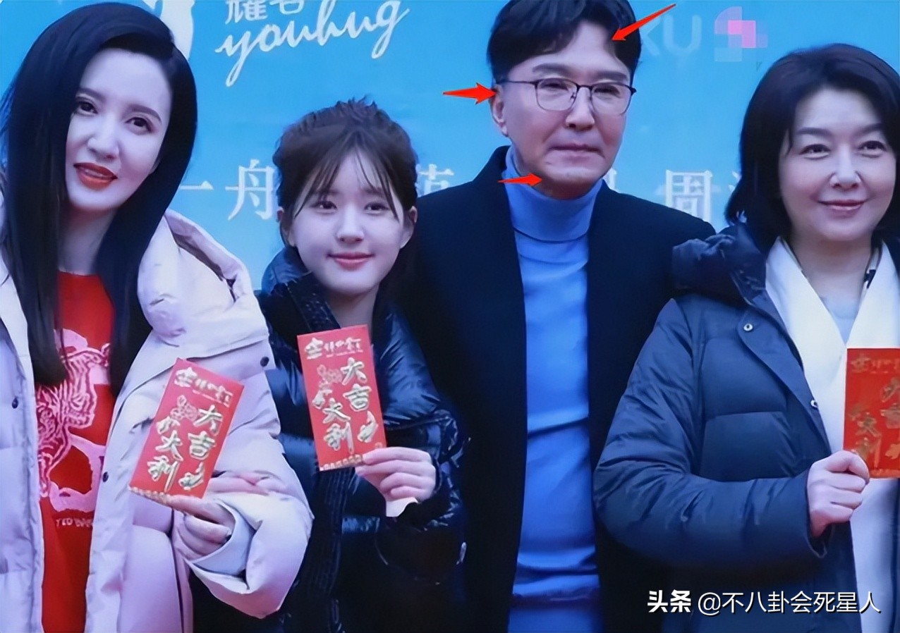 男星整容的有哪些,因为整容逆天改命的男明星