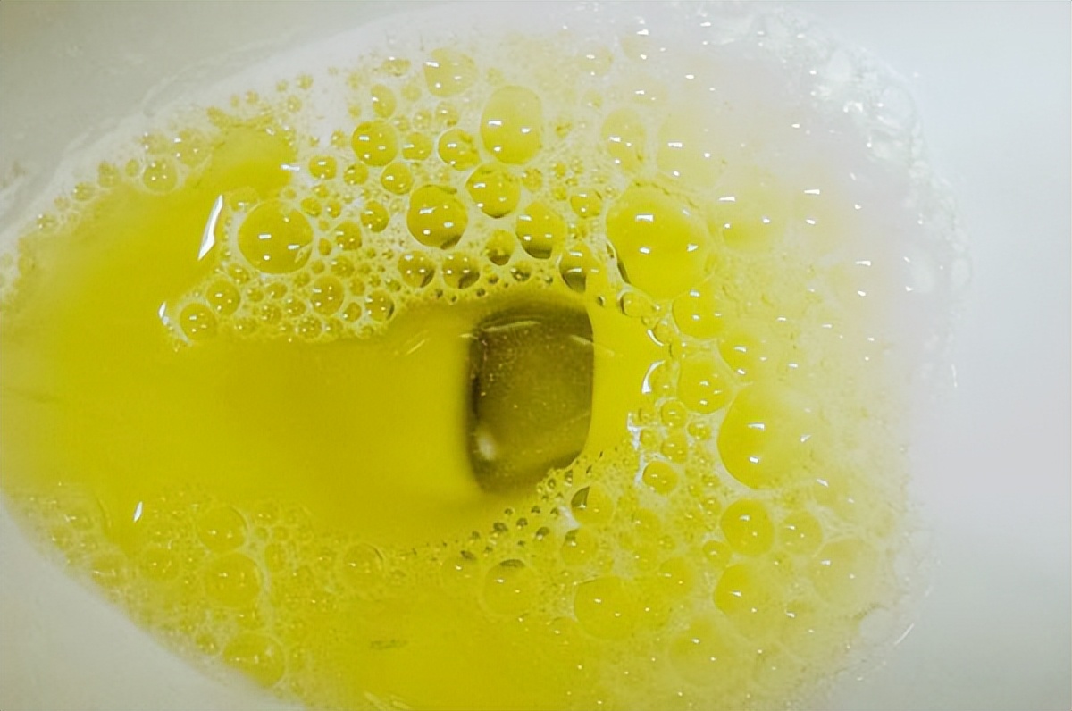 肾炎引起的浑身乏力怎么解决,慢性肾炎及时治疗会肾衰竭吗