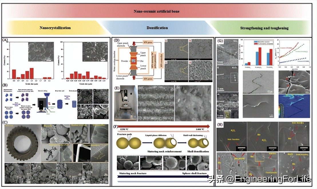人造骨骨移植研究进展！面临三大挑战并进行未来展望