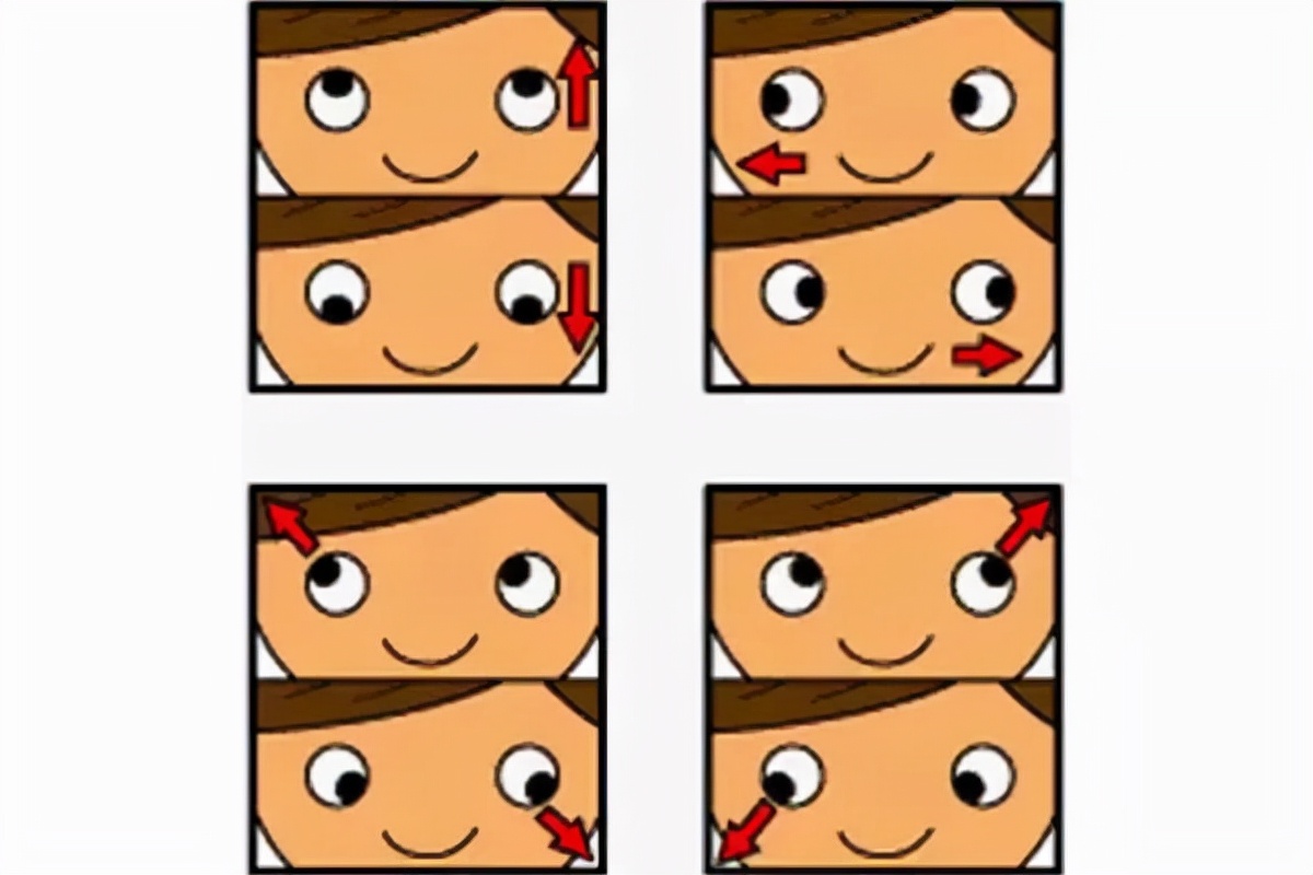 甲亢眼睛涩会突眼吗,甲亢突眼的护理措施