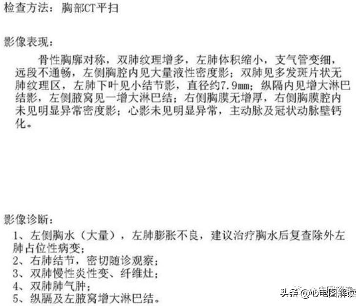 胸导联低电压危害,胸导联低电压临床意义