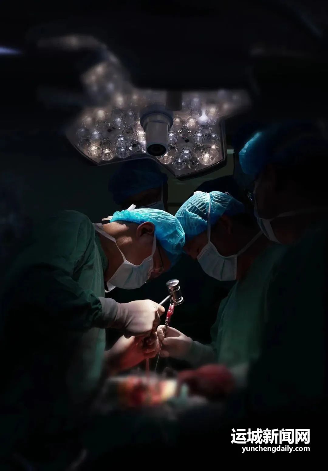 儿童脊柱侧弯手术是微创吗,脊柱侧弯儿童矫形术