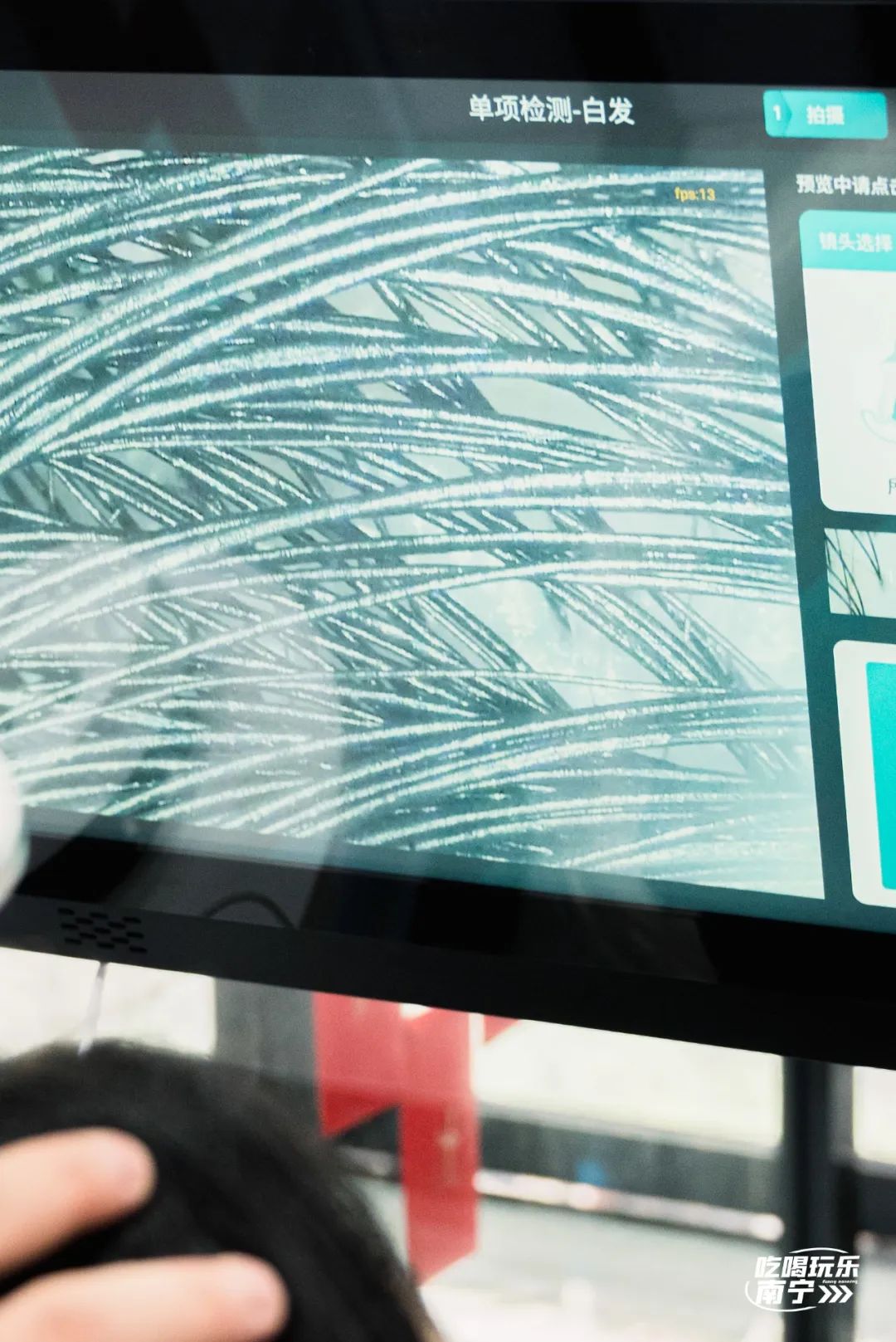 大数据请把这篇文章推给头发焦虑的南宁人