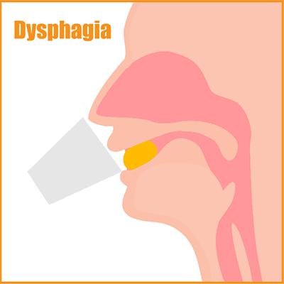 吞咽困难用什么辅助仪,吞咽障碍一招解决