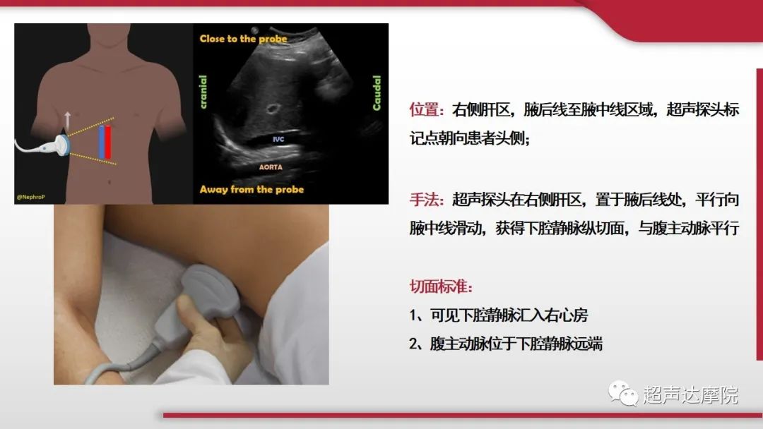 超声ppt课件大全,下腔静脉彩超评估容量