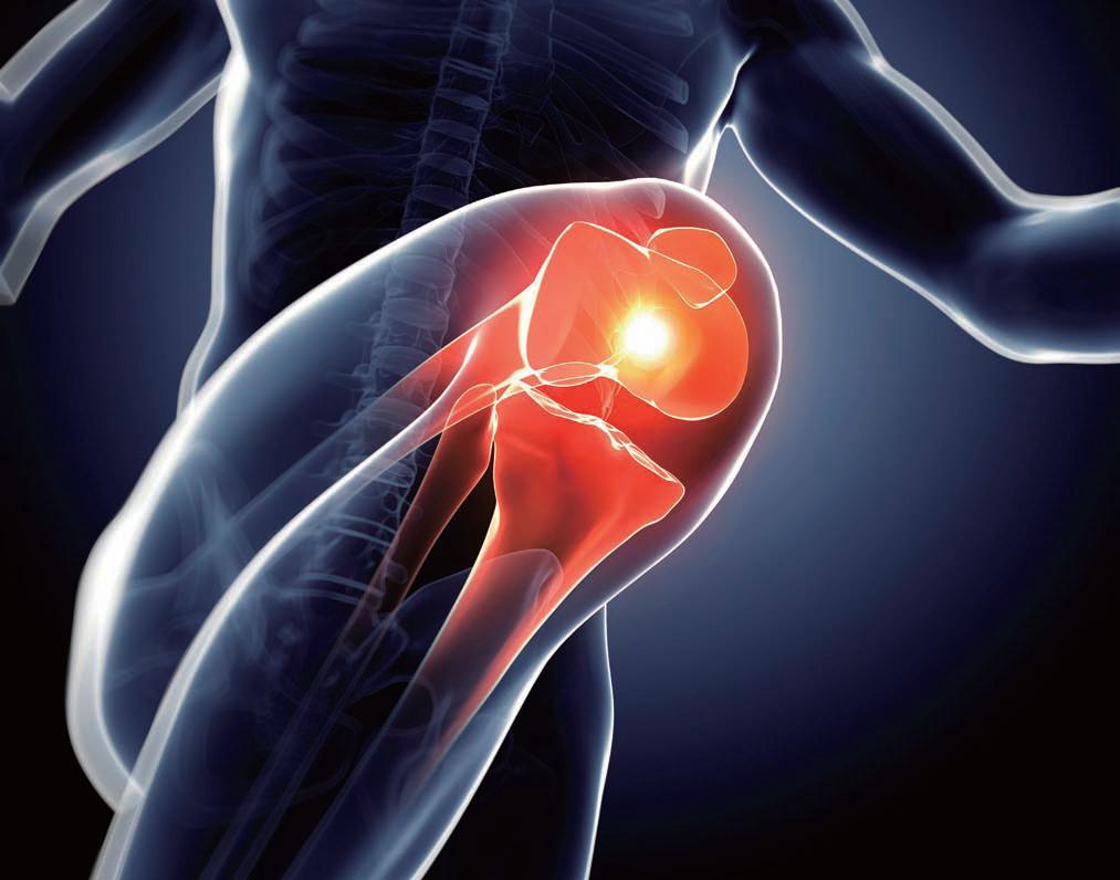 高尿酸是吃出来的少吃六种食物,高尿酸最怕六种食物