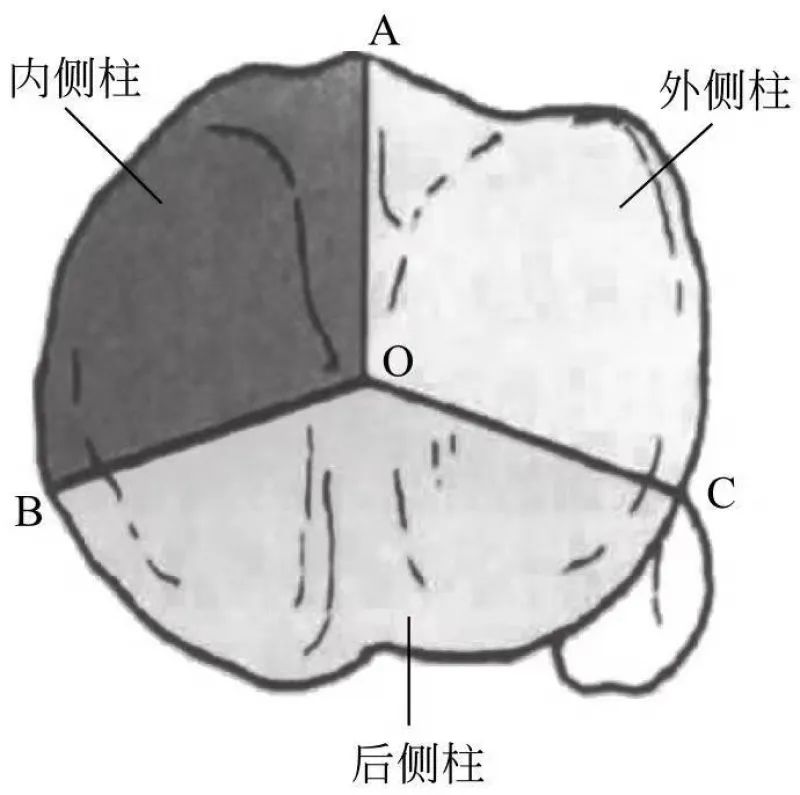 胫骨平台骨折分型及治疗ppt,胫骨平台骨折保守治疗可以评几级