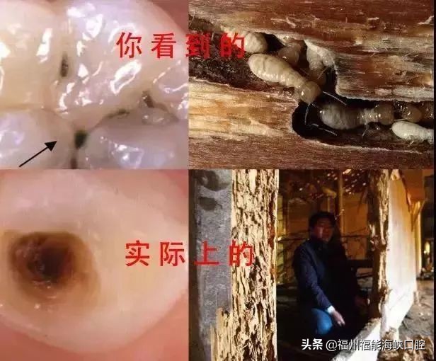 牙齿长黑线？你的牙危险了！教你怎么补救