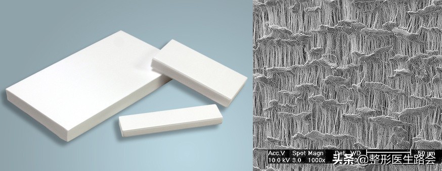 膨体真实感染率,膨体感染率有多高