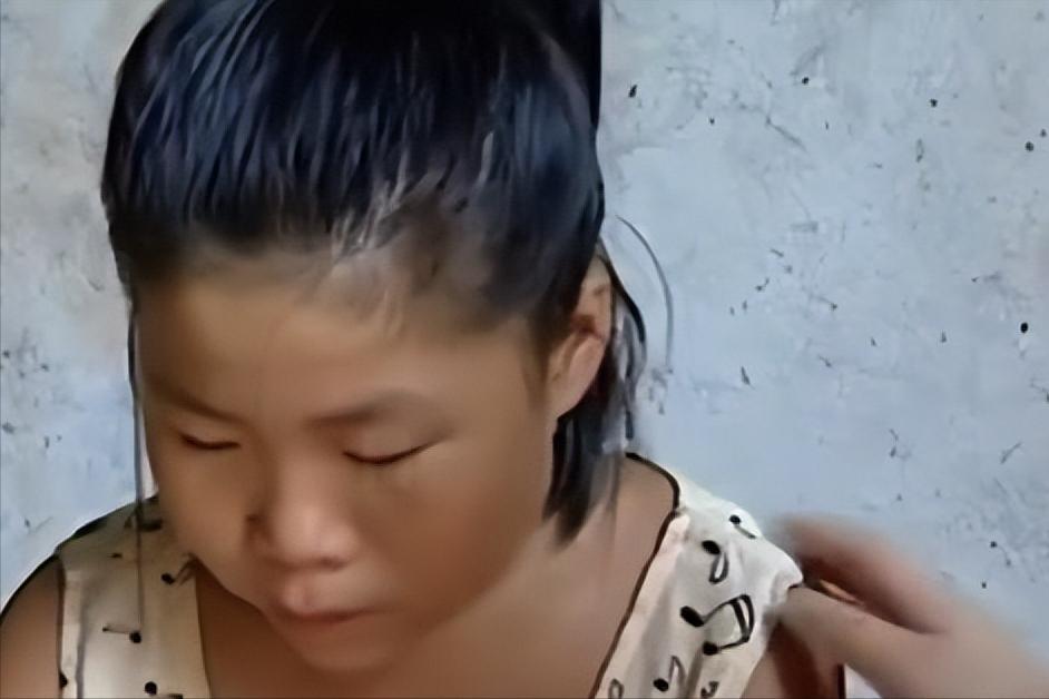 父亲瘫痪在床被老鼠啃食,瘫痪父亲被老鼠啃