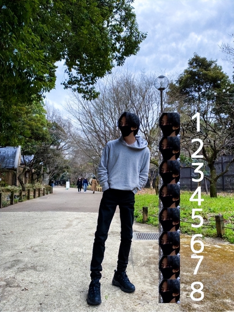 日本1米5小哥砸1600万疯狂整容增高！断骨惨烈过程吓傻网友