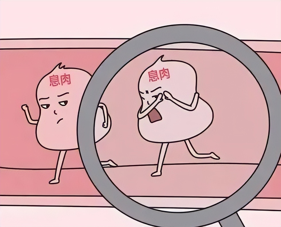 息肉反反复复，将胃息肉“连根拔起”？这2种药必不可少！