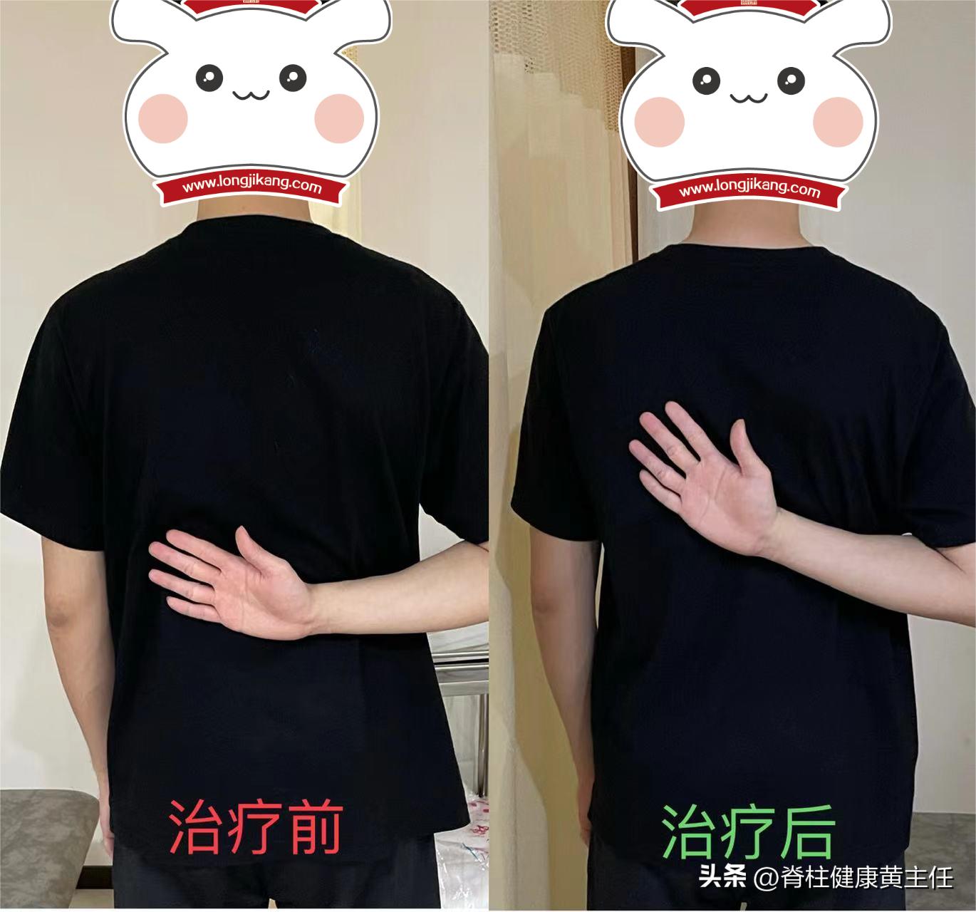 肩膀连着手臂后背痛怎么回事,肩膀痛但又摸不到痛哪里怎么回事