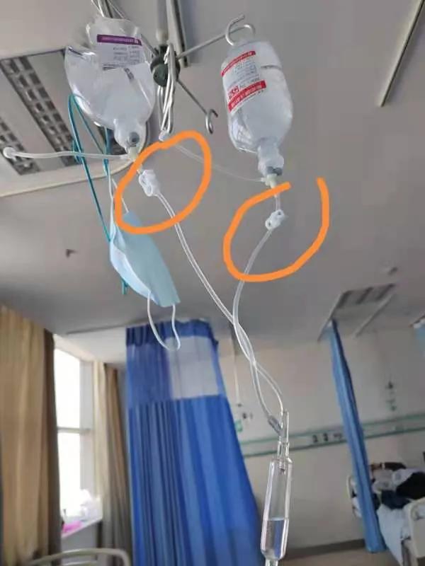 记录一次自己的手术经历,记录胆囊切除手术