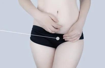 中医治疗盆腔炎期间白带多,寒湿盆腔炎附件炎吃什么中成药