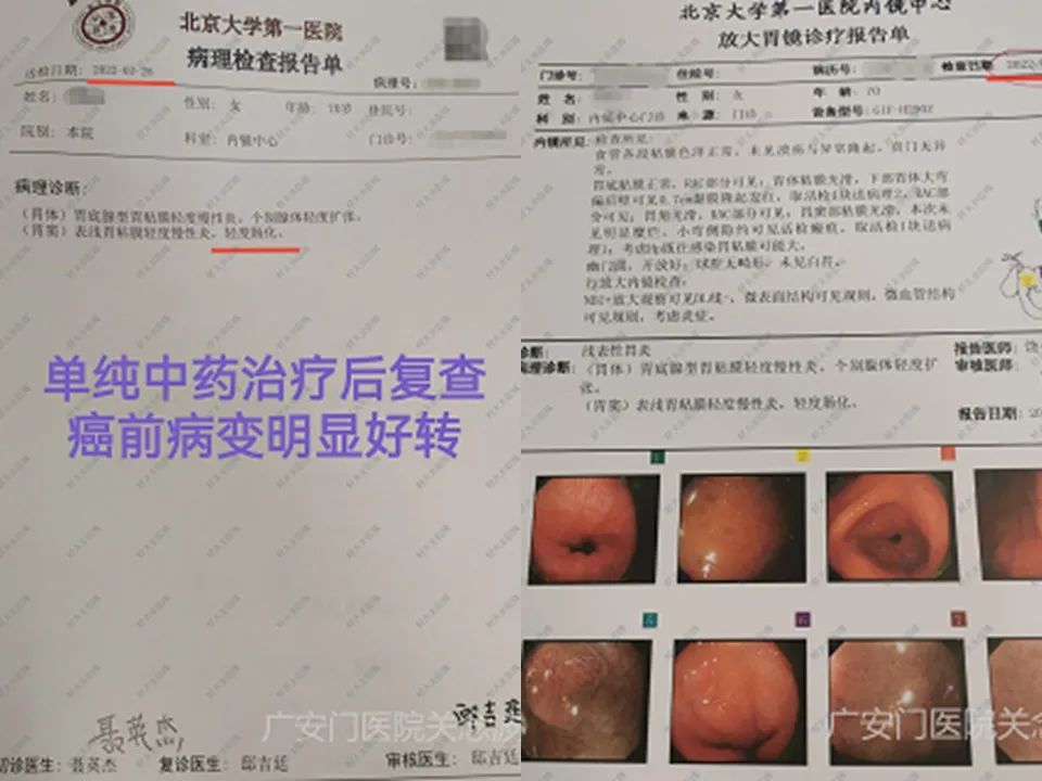 正确使用中医药治疗肿瘤才显效,关于中医中药在肿瘤治疗中的见解