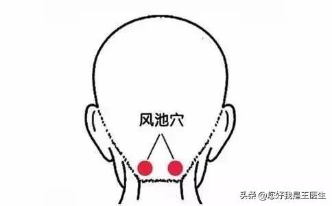 中医神奇的放血术，一针治疗偏头痛