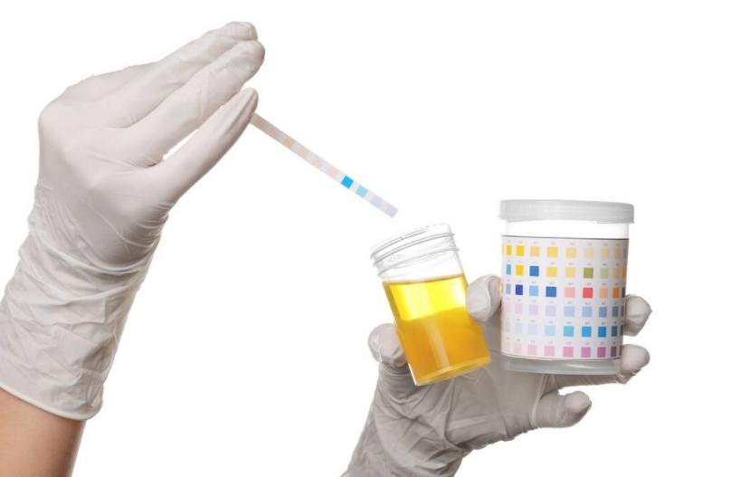 尿酸高的严重后果的视频,尿酸偏高身体会出现这几种症状