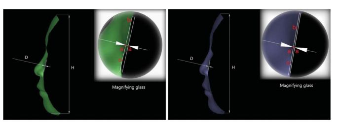 印第安纹解剖学,印第安纹分型对策