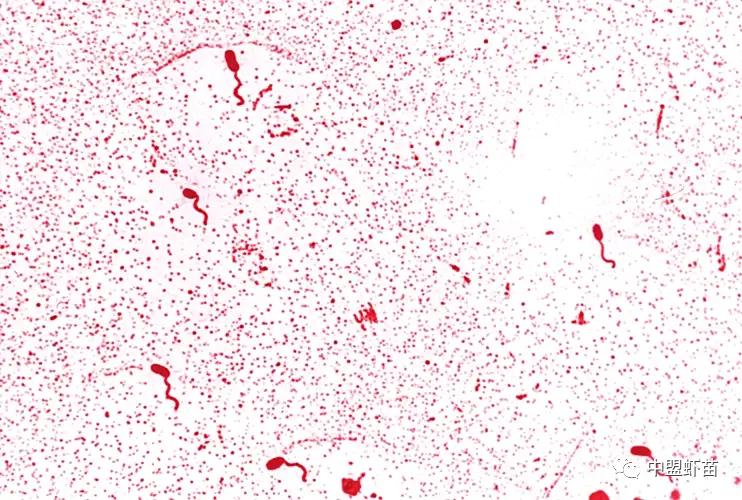 弧菌种类,弧菌大全