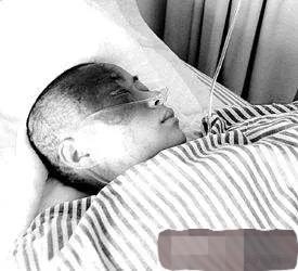 硫酸泼脸自救,硫酸泼到身上怎么自救