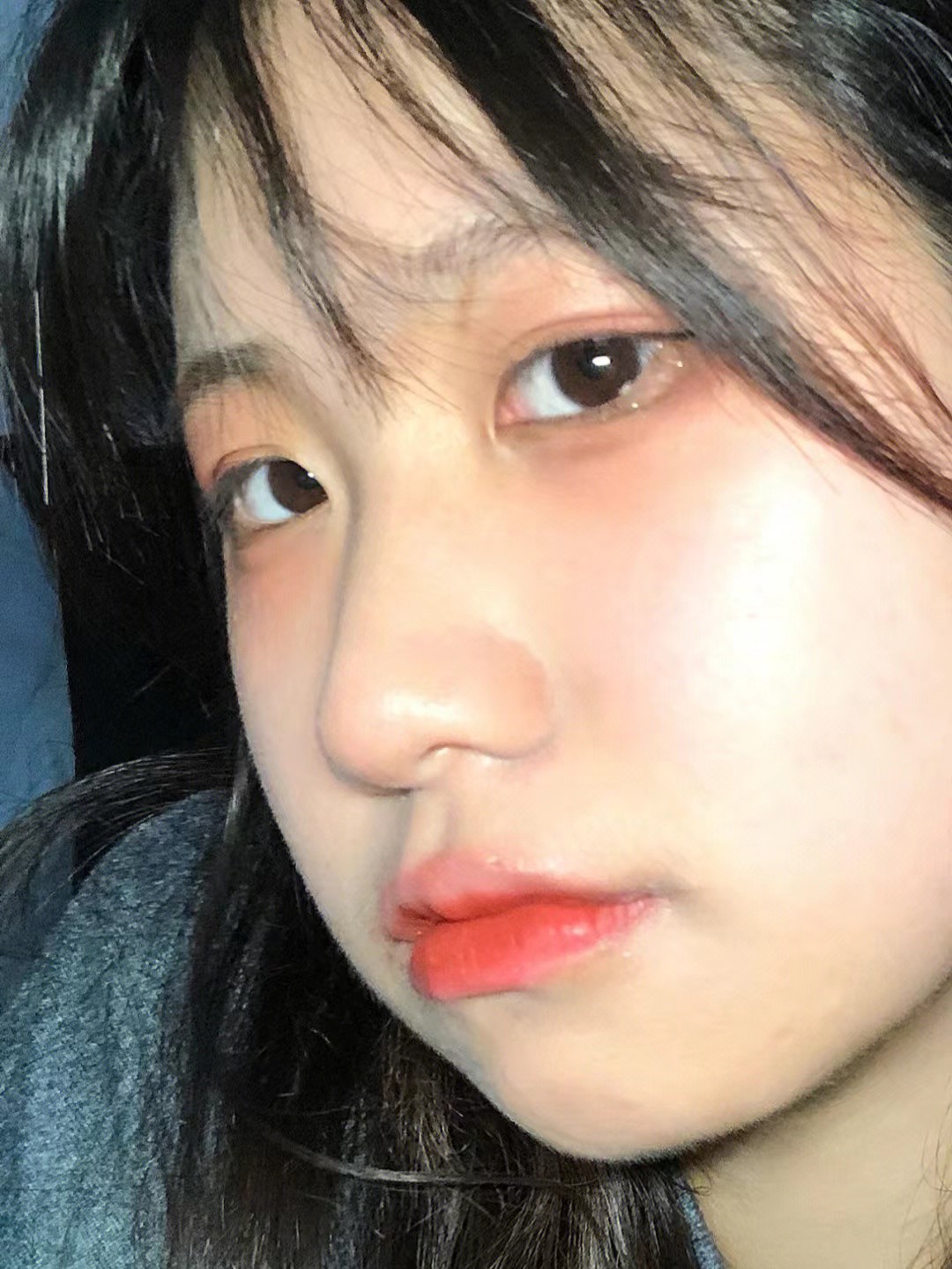 下巴总长痘痘抹什么药,下巴总长痘痘和闭口怎么办