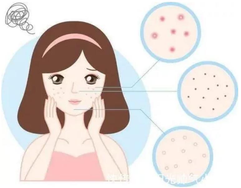 过敏性皮炎干燥红痒是怎么回事,红斑丘疹神经性皮炎