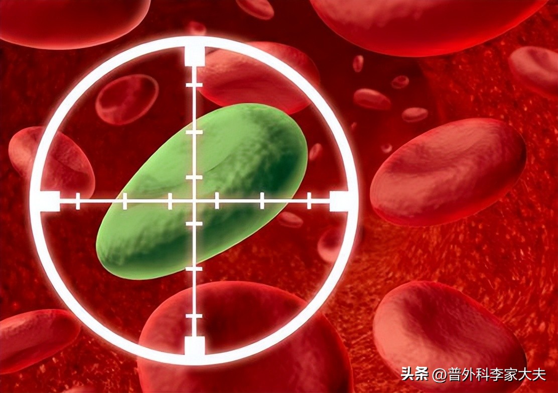 晚期肠癌的靶向和免疫治疗,治疗肠癌的靶向药都有哪些