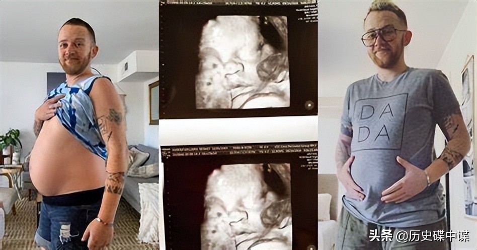 美国女子变性后诞下一子,美国变性手术生孩子