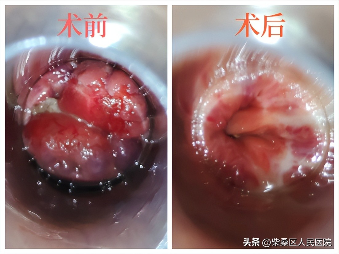 肛肠科女大夫,肛肠科女专家