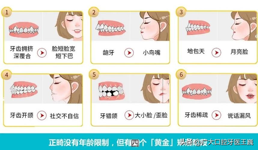 牙齿正畸矫正一般需要多久,正畸科普牙齿矫正的年龄限制问题
