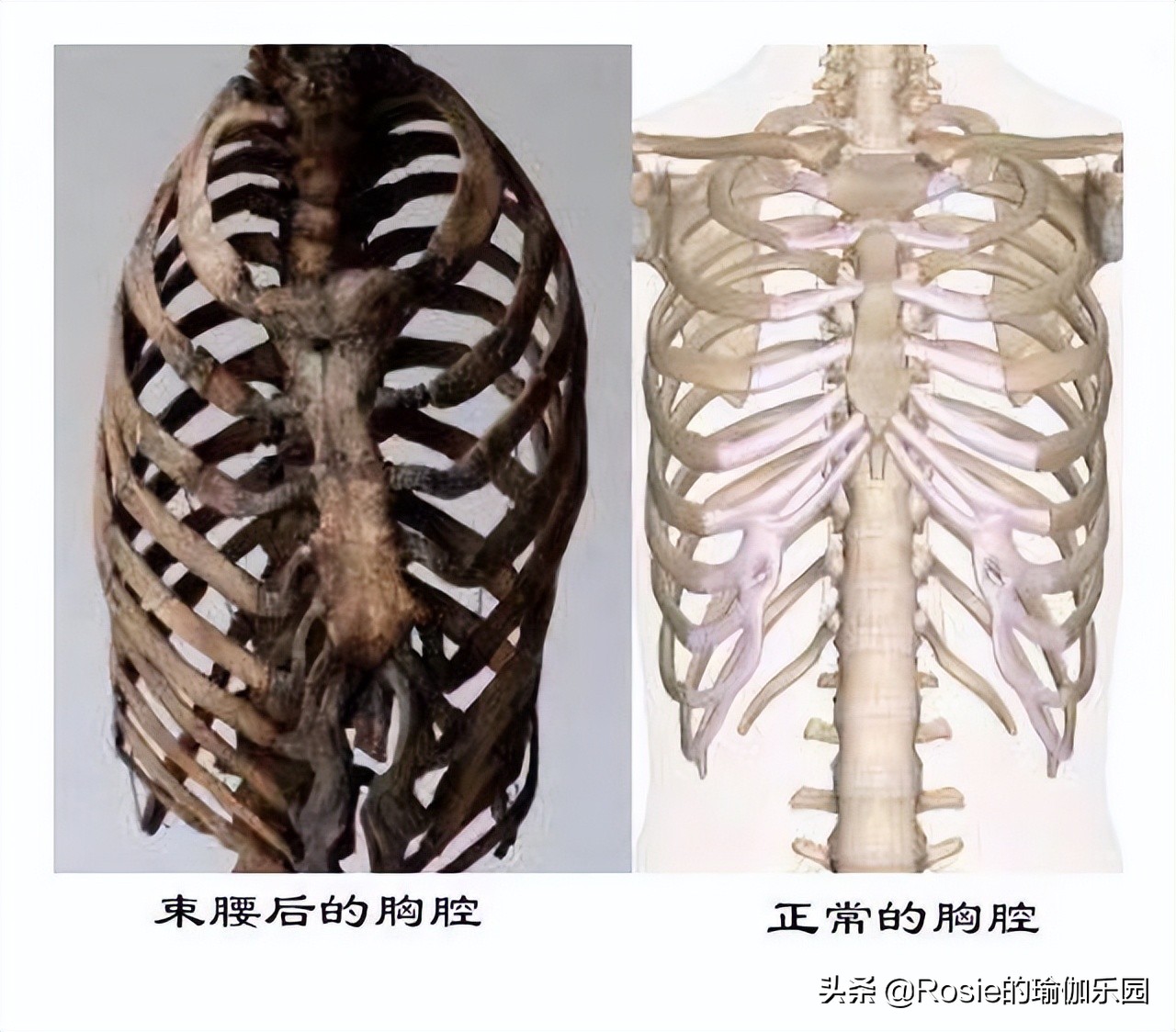 赵丽颖马甲线减肥方法,赵丽颖瘦了4公斤还练出马甲线