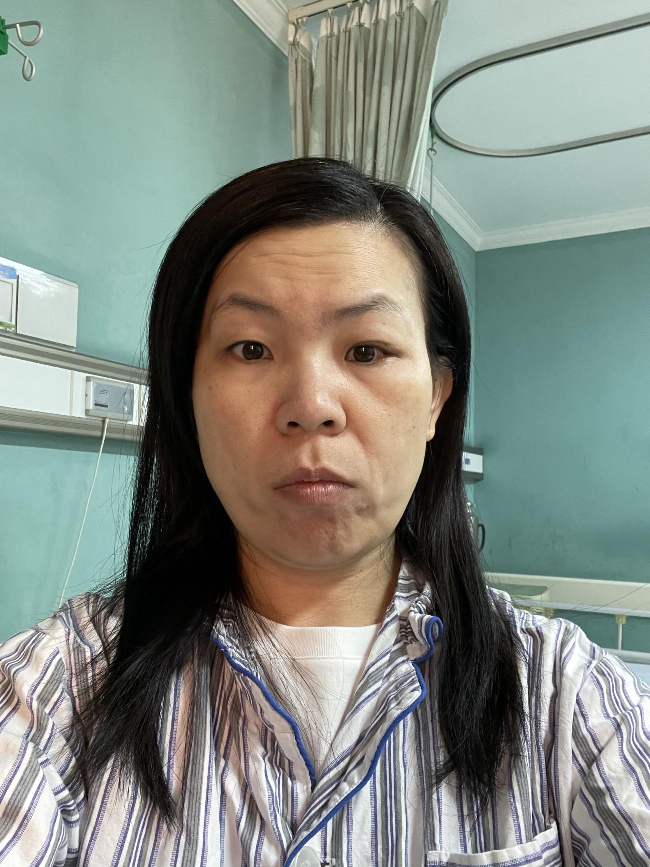 终于找到正确的医生治疗我的眼眶蜂窝织炎：详细记录住院康复经历