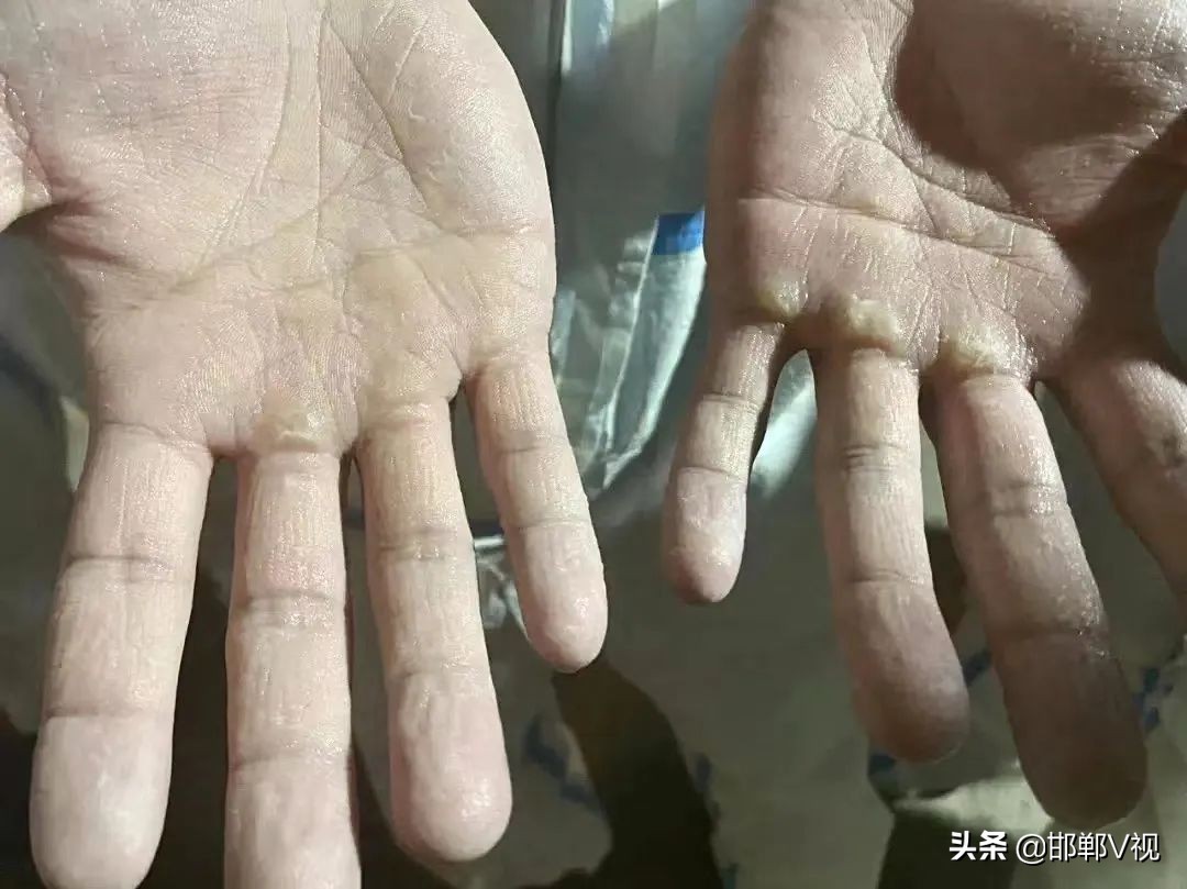 閭兏鎶楃柅鑻遍泟鐓х墖,閭兏鐤儏娴锋姤