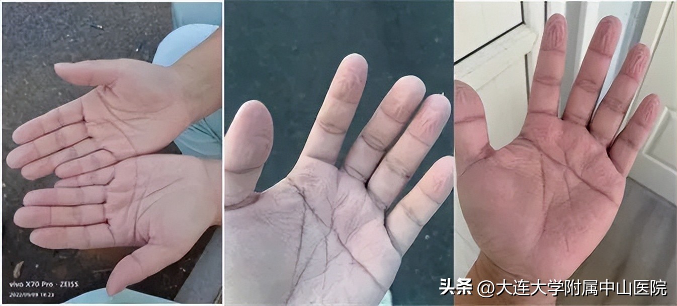 【战疫回忆】“疫”路同行情意更浓