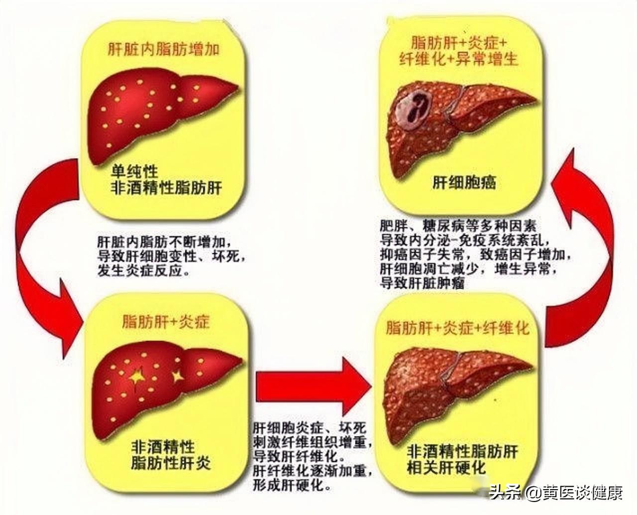 乙肝大三阳10多年,乙肝表面抗体升高至28说明什么