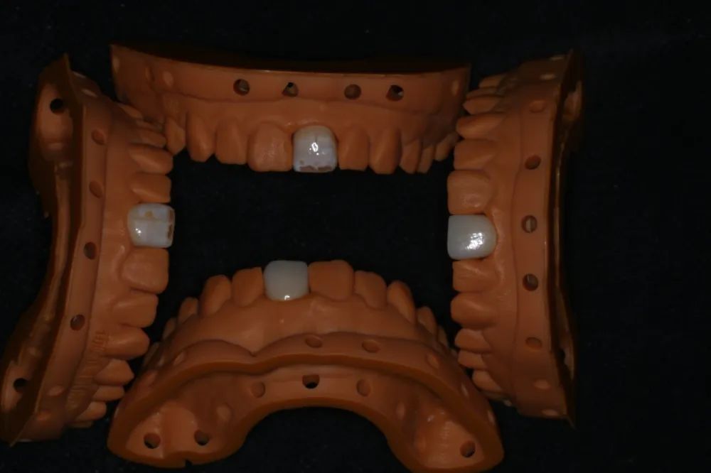 口腔椅旁培训,培训椅子修补