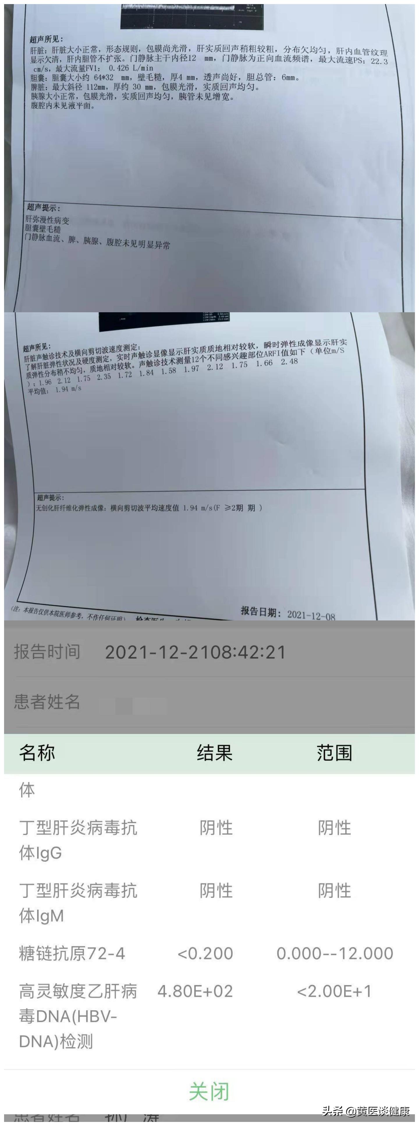 有肝癌家族史后代要打加强针吗,有家族肝癌史患者要抗病毒治疗吗