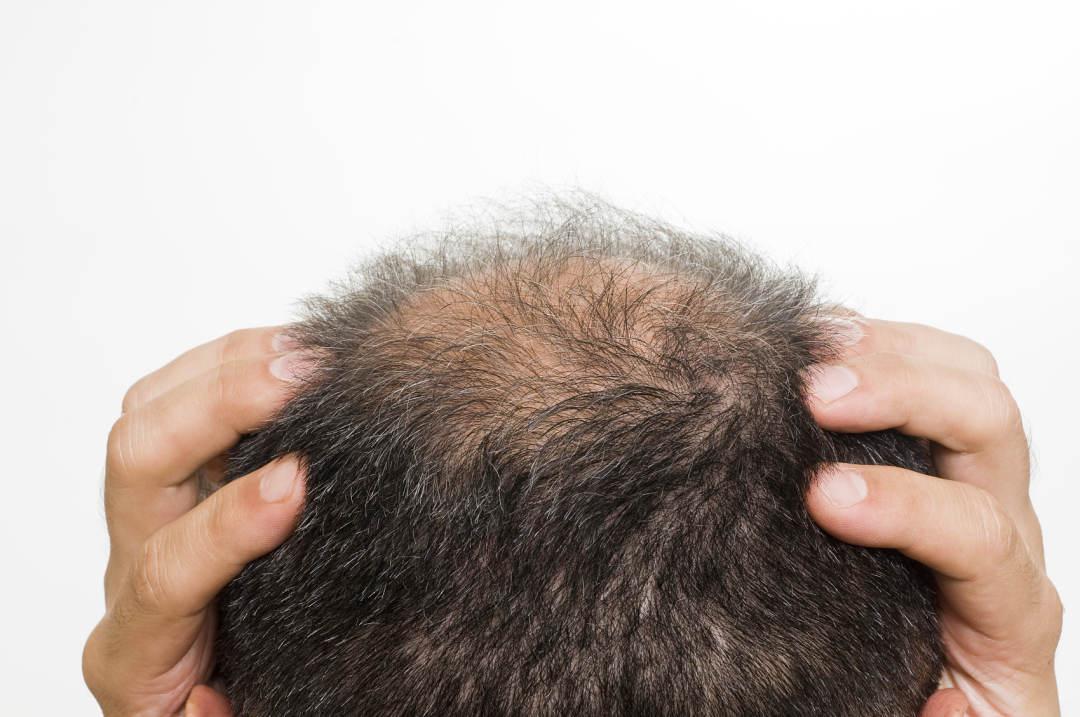 阳康后运动会猝死吗,阳康后剧烈运动死了