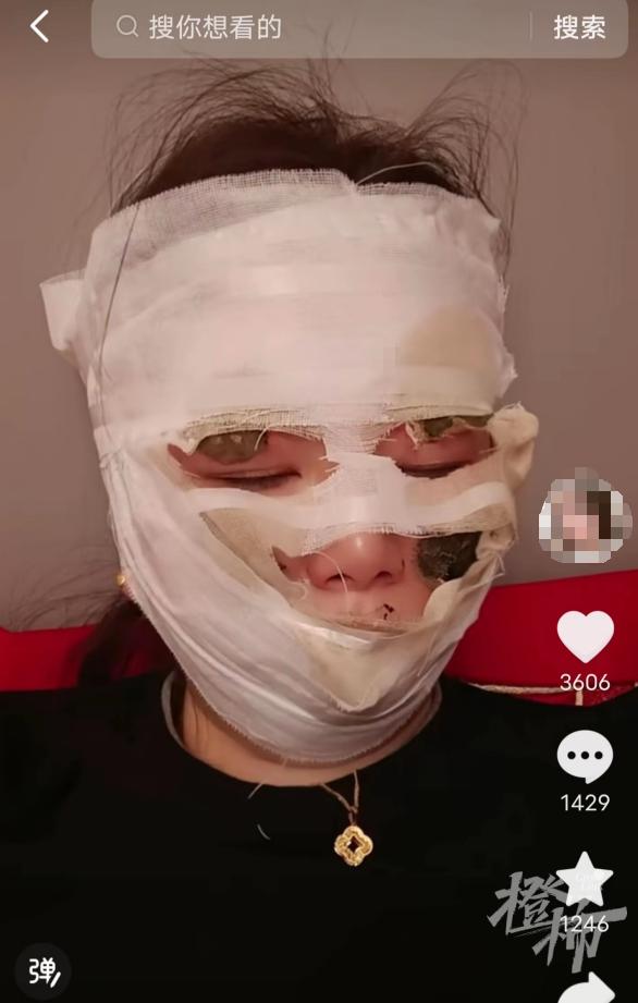 婚礼当天新娘险被毁容,婚礼上新娘险被毁容