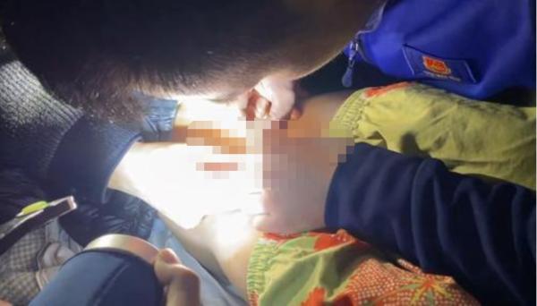 俩月出现两次，拉链咬伤男童*体下**，建议穿松紧带裤减少意外出现