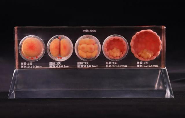 世界首例3d打印房子,全球首例3d打印移植